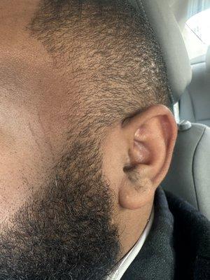 Scratches from barber