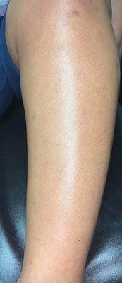 After clients leg wax. Client said "WOW, it didn't even hurt and my legs are so smooth!"