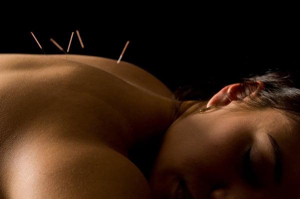 Painless needling. Refreshing, effective treatments