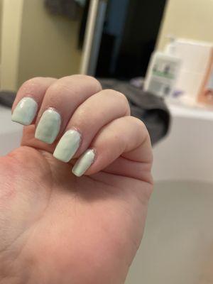 Uneven gel application