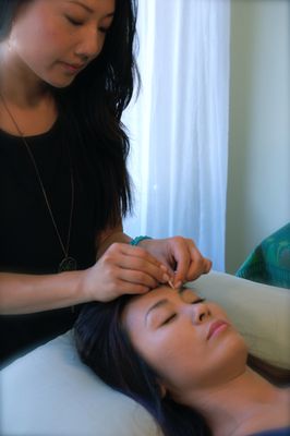 Facial rejuvenation acupuncture treatment