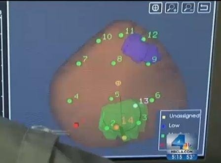 Eigen's Target Biopsy System