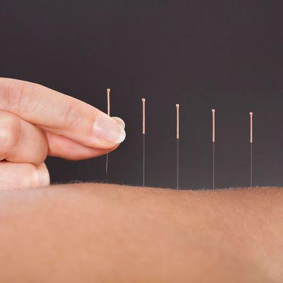 Acupuncture helps to heal an enormous array of symptoms including pain, autoimmunity, mental and emotional, fertility, digestion, and more.