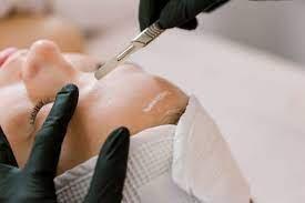 Dermaplaning