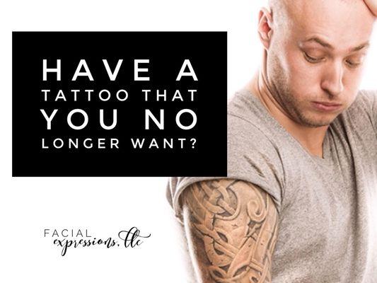 Tattoo Removal