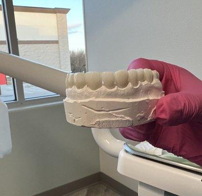 January 2023 Getting Ready  Dr. Hala Mustafa 1385 Dental Studio in Aubrey, Texas.