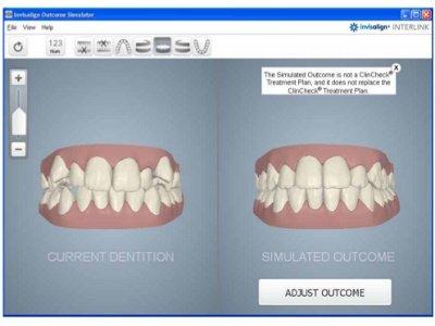 FREE Invisalign Scans!