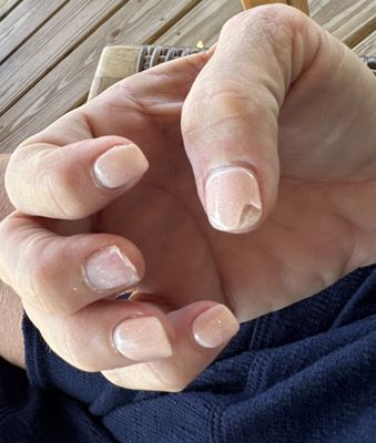 Fingernails