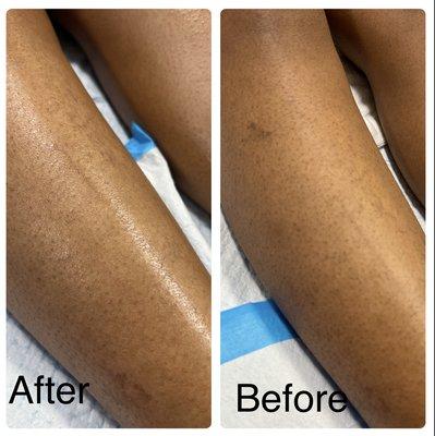 Before and after leg wax