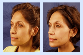 Florida Ear Nose Throat & Facial Plastic Surgery Center