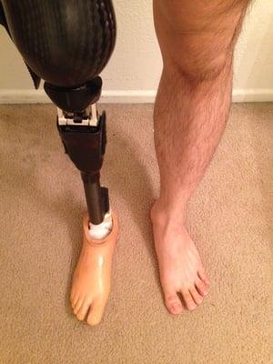 Performance Prosthetics and Orthotics Specialists