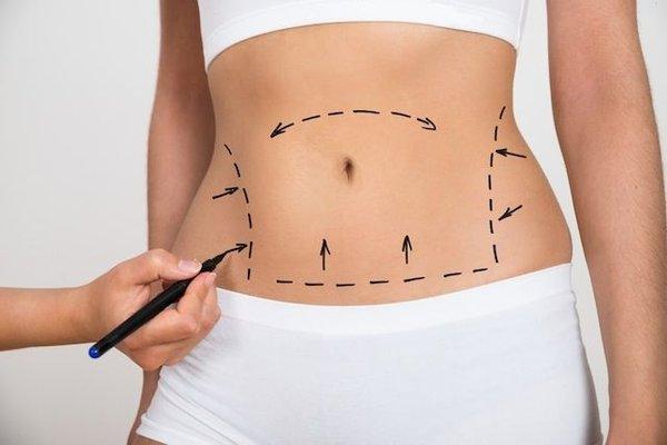 #body Countering at Birmingham Cosmetic Surgery.  Call for a free consultation  2487239370