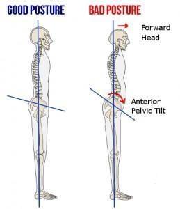 Your posture is directly related to your overall health and puts continues stress on your spine and nervous system when out o...