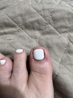 My toe this morning