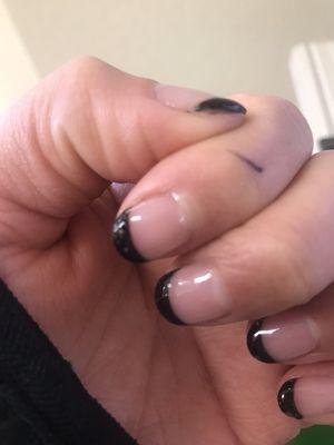 Chipped thumb nail