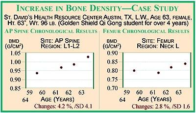 Bone Density progress for a young lady (62) who was doing Golden Shield Qi Gong