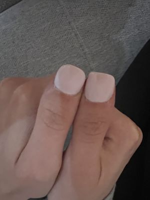 my thumbs are not even the same shape!