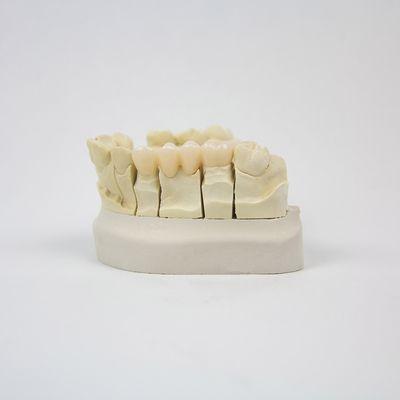 Zirconia Crown & Bridge