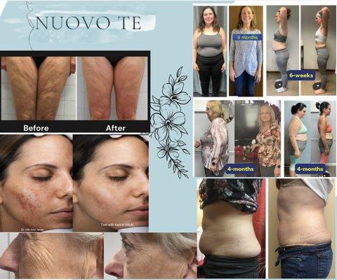 Medical Grade Facials with plant-based stem cells, Cryo T Shock & Sentient cellulite & fat reduction, Tixel skin resurfacing, Weight Loss!