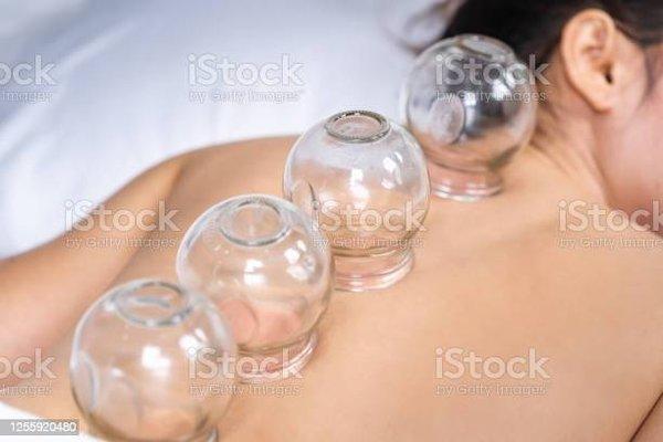 Cupping releases toxins and relaxes the deep muscles.