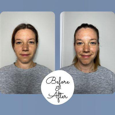 Before & After Helena Pahava Manual Facelift. Experience relaxation and a beautiful natural face lift with massage techniques