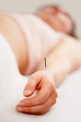 Bu Tong Acupuncture