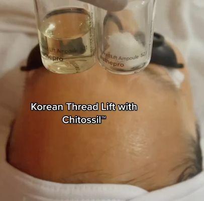 Korean Thread Lifting