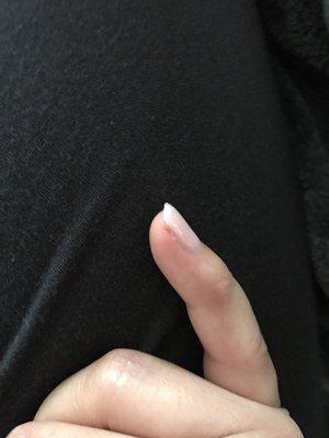 When the guy doing your nails doesn't stop filing like a maniac even after being told. (After cut was clean pic was taken).