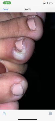 Got pedi last week and this happen infection  please stay away