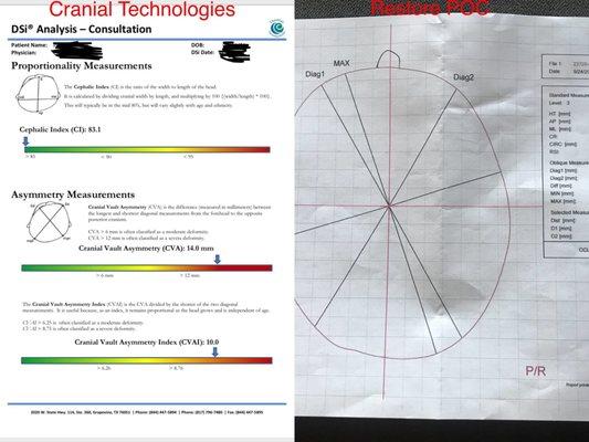 Cranial Technologies gave me a 7 page report with the results. Restore POC gave me a one sheet print out.