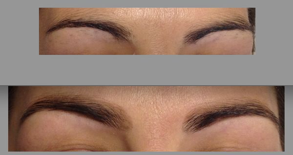 Before: Sparse and uneven brows. After: Fuller, more defined, and symmetrical brows with a smooth arch, enhancing the overall eye area.