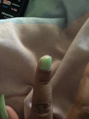 My broken nail