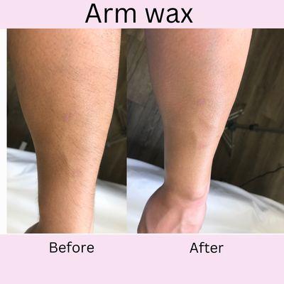 Before and after arm wax