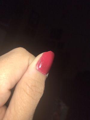 Day two, chipped nail, you can see my previous nail color under, nail polish doesn't cover my entire nail