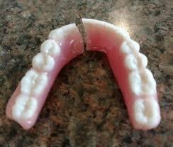 broken lower denture