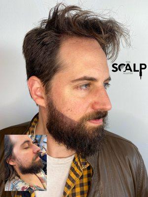 The Scalp Master