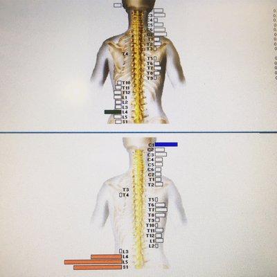 Hmmm, interested to see how your spine really looks? Go get your spine scanned and checked!!