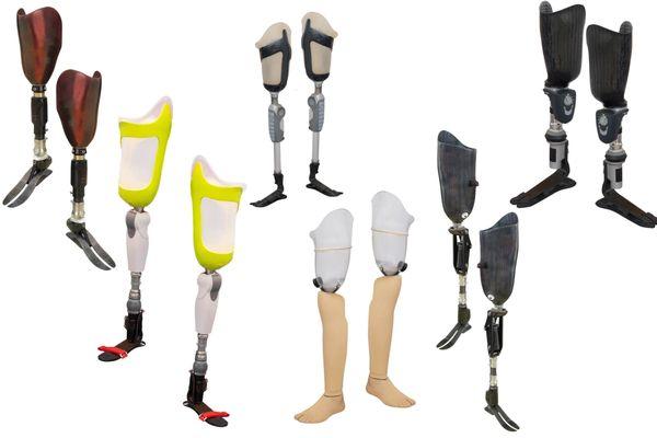 Above Knee Prosthesis