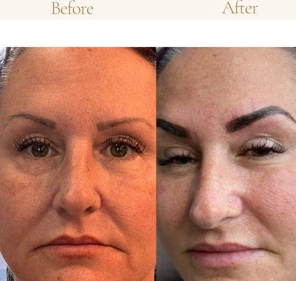 Brow Correction. Old brow tattoos can be retouched with color and reshaped to bring more balance to face, according to your desire.