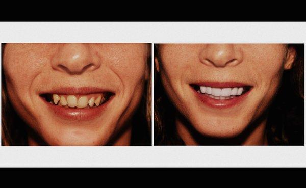 Before & After Dental Treatment