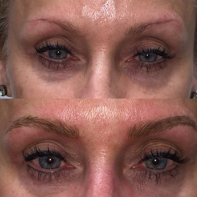 Microblading