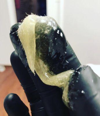 Hair pulled out from Sugar