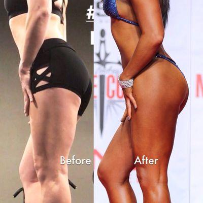 Before/After bodywork to help eliminate cellulite on the back of my thighs. It worked!!!