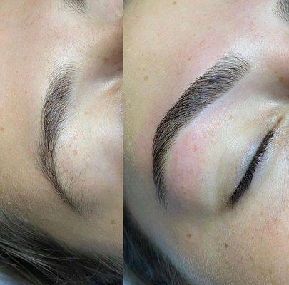 Brow transformation