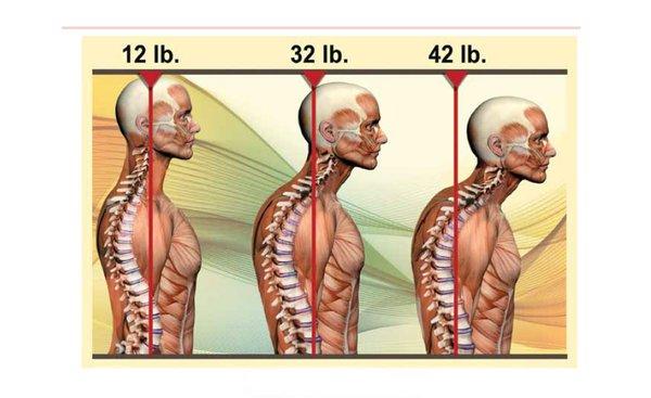 Let Structura get your head on top of your shoulders again.  We facilitate change to the boney framework through the fascia of the body.