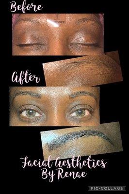 Micro Blading eyebrows