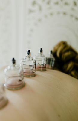 Cupping Therapy