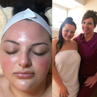 Oxylight Facial with Lea!