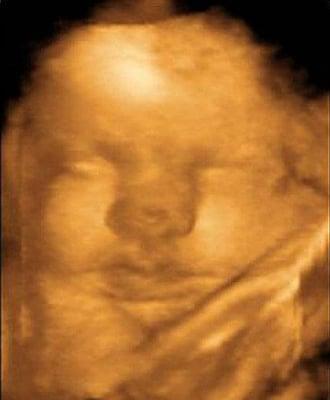 We provide ultrasounds from 15 to 33 weeks.