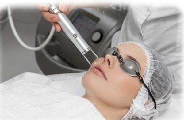 Picosure laser rejuvenation